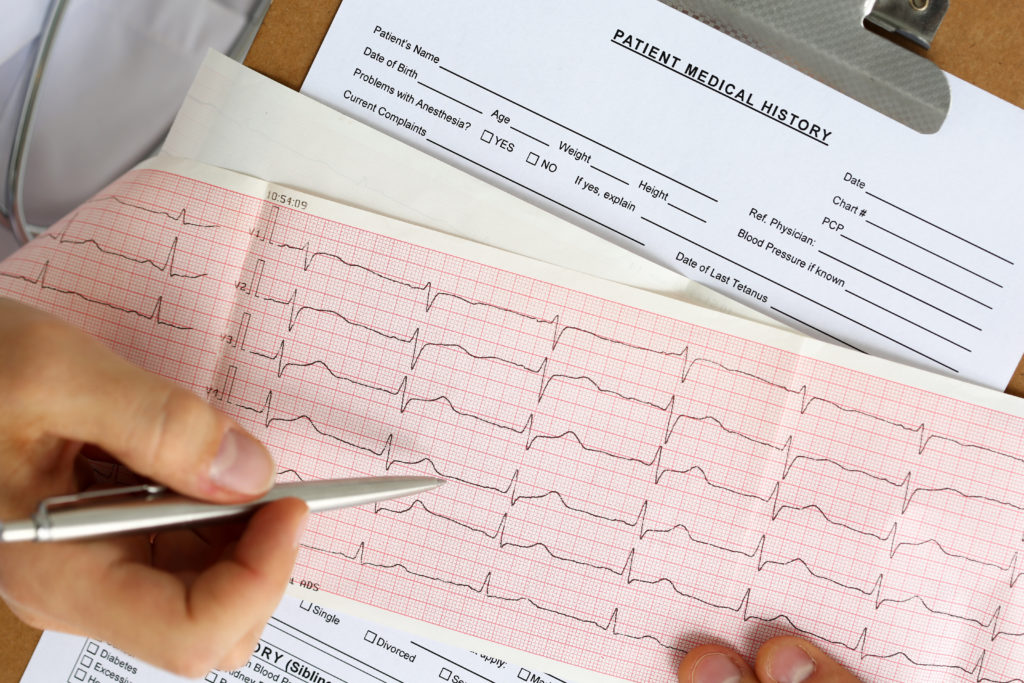 elettrocardiogramma (ECG)