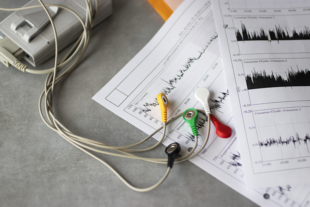 Apprecchio ECG Holter