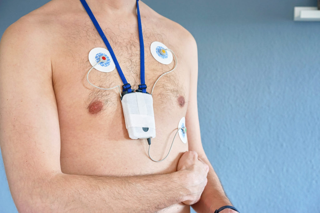 ECG Holter a 3 derivazioni